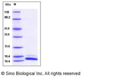Sino Biological Human TCL1A Protein (His Tag) 100ug, Quantity: Each of