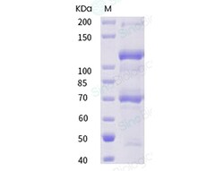 Sino Biological Human complement C3 Protein (His Tag) 100ug, Quantity: