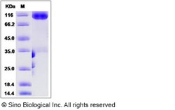 Sino Biological Human MAG / GMA / Siglec-4 Protein (Fc Tag) 100ug, Quantity: