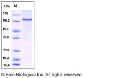 Sino Biological Human STAT4 Protein (His Tag) 50ug, Quantity: Each of 1