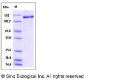 Sino Biological Recombinant Human STAT6 Protein (His Tag), Quantity: Each