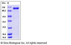 Sino Biological Human Thyroid peroxidase / TPO Protein (257 Ser/Ala, 725