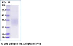 Sino Biological Recombinant Human CD79A Protein (ECD, His Tag), Quantity: