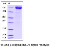 Sino Biological Recombinant Human Interferon alpha/beta receptor 1 Protein
