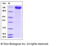 Sino Biological Recombinant Human Interferon alpha/beta receptor 1 Protein