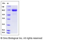 Sino Biological Recombinant Human Alkaline phosphatase/APLI Protein (His