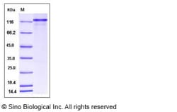 Sino Biological Human P63 / TP63 / Tumor protein p63 Protein (His & GST