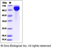 Sino Biological Human AFM / Afamin Protein (His Tag) 50ug, Quantity: Each