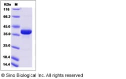 Sino Biological Recombinant Human CART Protein (mFc Tag), Quantity: Each