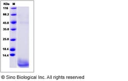 Sino Biological Recombinant Human CART Protein, Quantity: Each of 1