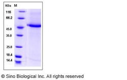 Sino Biological Human CST9L / Testatin Protein (Fc Tag) 100ug, Quantity: