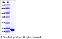 Sino Biological Recombinant Human GMF Beta/GMFB Protein, Quantity: Each