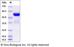 Sino Biological Recombinant Human FKBP7 Protein (hFc Tag), Quantity: Each
