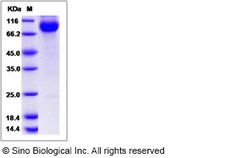Sino Biological Recombinant Human CDCP1 Protein (Secreted Form, mFc Tag),