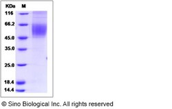 Sino Biological Recombinant Human CDCP1 Protein (Secreted Form, His Tag),