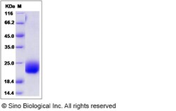 Sino Biological Recombinant Human CCDC47 Protein (His Tag), Quantity: Each