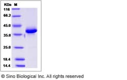 Sino Biological Recombinant Human CALCB Protein (mFc Tag), Quantity: Each