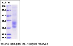 Sino Biological Recombinant Human TMEM27 Protein (His Tag), Quantity: Each