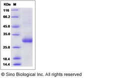 Sino Biological Recombinant Human TMED1 Protein (His Tag), Quantity: Each