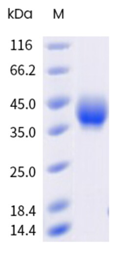 Sino Biological&nbsp;Recombinant Human EPCR Protein (His Tag), Biotinylated, HPLC-verified 20 µg