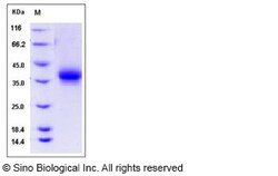 Sino Biological Recombinant Human EPCR Protein (His Tag), HPLC verified,