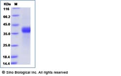 Sino Biological Human CNPY3 / PRAT4A / ERDA5 Protein (His Tag) 50ug, Quantity: