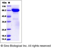 Sino Biological Recombinant Human ERP72 Protein (His Tag), Quantity: Each