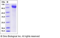 Sino Biological Recombinant Human TEM8/ANTXR1 Protein (hFc Tag), HPLC-verified,