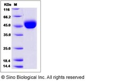 Sino Biological Recombinant Human LRG1 Protein (His Tag), HPLC-verified,