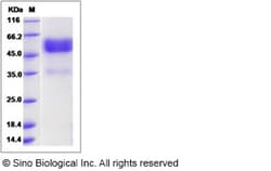 Sino Biological Recombinant Human TROY/TNFRSF19 Protein (hFc Tag) 1, Quantity:
