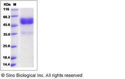 Sino Biological Recombinant Human TROY/TNFRSF19 Protein (hFc Tag), Quantity: