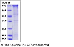 Sino Biological Recombinant Human FSTL5 Protein (hFc Tag), Quantity: Each
