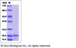 Sino Biological Recombinant Human MMP-26 Protein, Quantity: Each of 1