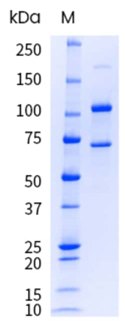 Sino Biological&nbsp;Recombinant Human Complement C5 Protein (His Tag), HPLC-verified, Endotoxin-Free