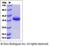Sino Biological Recombinant Human SCGB3A1 Protein (mFc Tag), Quantity: