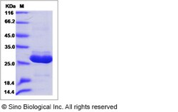 Sino Biological Human APOA1BP / AIBP Protein (His Tag) 100ug, Quantity: