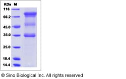 Sino Biological Recombinant Human UNC5A Protein (ECD, hFc Tag), Quantity:
