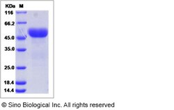 Sino Biological Recombinant Human UNC5A Protein (ECD, His Tag), Quantity: