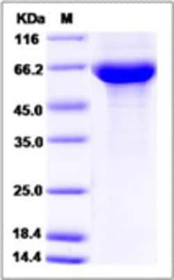 Sino Biological Recombinant Human IGSF8 Protein (His Tag), Quantity: Each