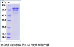 Sino Biological Recombinant Human Secretogranin II Protein (His Tag), Quantity: