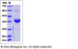 Sino Biological Recombinant Human SMR3B Protein (mFc Tag), Quantity: Each