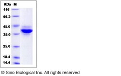 Sino Biological Recombinant Human JTB Protein (mFc Tag), Quantity: Each