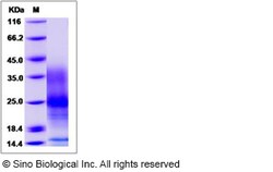 Sino Biological Recombinant Human VIP Protein (His Tag), Quantity: Each