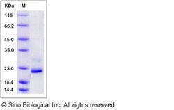 Sino Biological Human Lysozyme G-like 1 / LYG1 Protein (His Tag) 100ug,