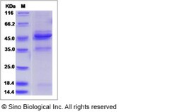 Sino Biological Recombinant Human TMP21 Protein (mFc Tag), Quantity: Each