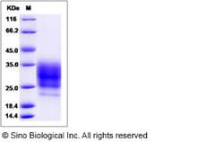 Sino Biological Human RNase A / Ribonuclease A / RNASE1 Protein (His Tag)