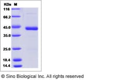 Sino Biological Recombinant Human SF20 Protein (mFc Tag), Quantity: Each