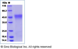 Sino Biological Human OGN / osteoglycin protein (His Tag) 50ug, Quantity:
