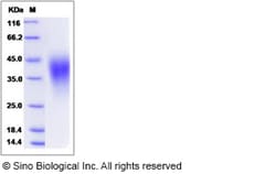 Sino Biological Recombinant Human VISTA/B7-H5 Protein (His Tag), HPLC-verified,
