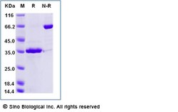 Sino Biological Recombinant Human FGL1 Protein (His Tag), HPLC-verified,